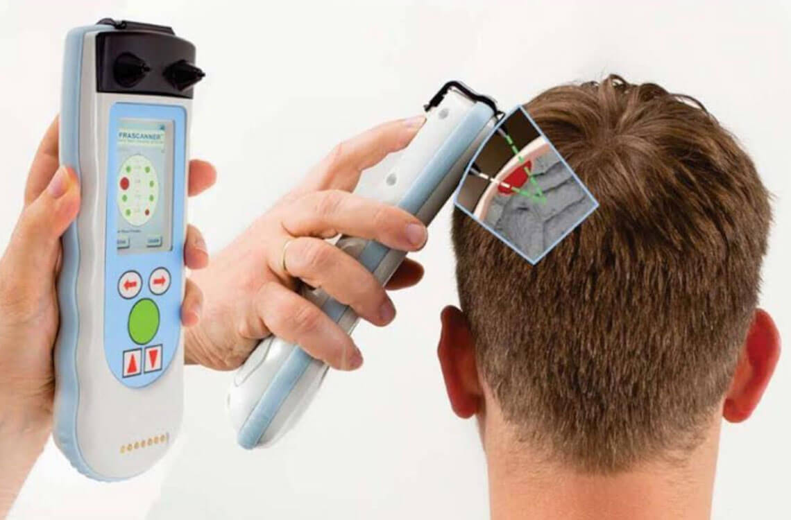 brain scanner
